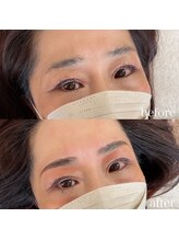 ダリ(Dali)/ハリウッドブロウリフト