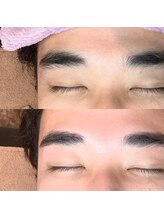 リリー(Lily)/【ワックス脱毛】