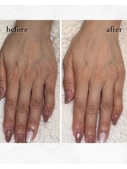 アトリエレポ/気になるくすみやシワに！