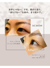 シェーン(schon)/守りながら綺麗をつくる