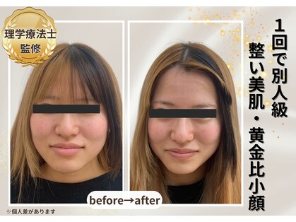 小顔美肌ファクトリー 梅田院の写真