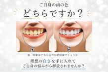 ホワイトニングショップ 越谷店