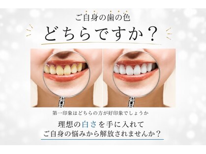 ホワイトニングショップ 越谷店の写真