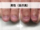 男性(自爪風)
