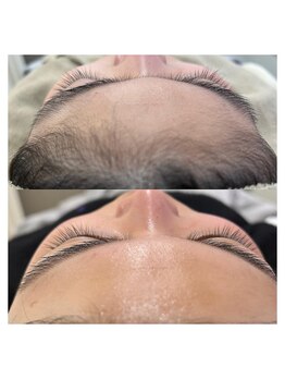 スイ 四条烏丸(SUI)/〇全顔シェービング