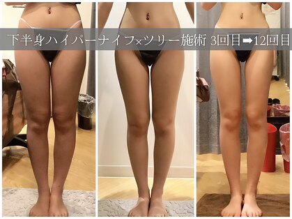 スリムプロ 堀江店(Slimpro)の写真