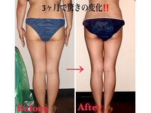 私たちの強力ハンドマッサージで美しいラインに仕上げます！