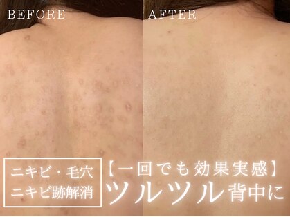 フォーウーマン(for woman)の写真