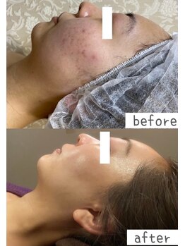 トモズサロン28(Tomos.salon.)/肌のバリア機能向上！