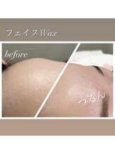 キュティル(Cutil)/フェイスワックスでお肌つるん