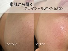 リモア(REMORE)/夏の時期大人気メニュー