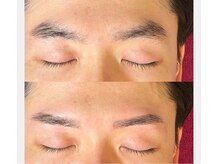 リジュベ(Rejuve)