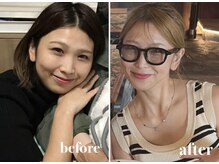 ノウ(NOU.)の雰囲気（フェイスラインが引き締まり、立体感/ハリ/弾力のある小顔へ☆）