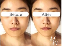 他では体感できない圧倒的な技術力/町田コルギ/町田小顔