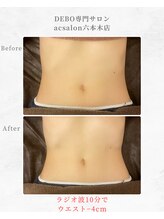 エーシーサロン 六本木店(acsalon)/くびれと共におへそが縦長に♪