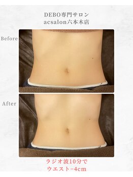 エーシーサロン 六本木店(acsalon)/くびれと共におへそが縦長に♪