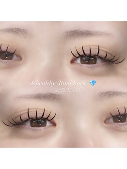 ベースメントアイスポット バイ ビュー(BaseMent eYe SPOT by V.I.E.W)/&healthy ★