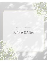 ビーホリック(Bholic)/Bffore&After