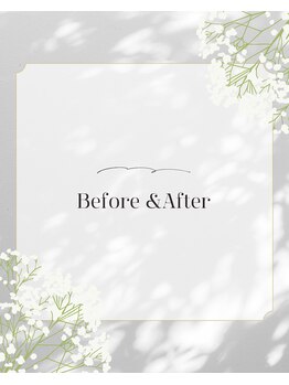 ビーホリック(Bholic)/Bffore&After