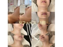 ミナミナ(MINA MINA)の雰囲気(宮城県初!リフェイス結果重視の最新リフトアップ&エイジングケア)