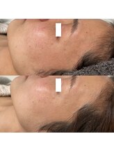 ヴェルシック(Belchic)/本来の美しさを取り戻す