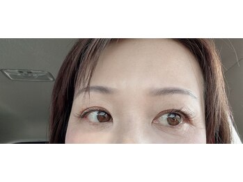 シアグレイス(SiaGrace)/