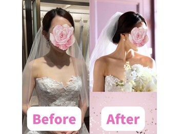 ボディキュア ブライダル美容整体 大阪梅田/見た目マイナス5キロ★/関西