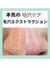 【長年の黒ずみ毛穴改善】毛穴エクストラクション＋光IPL＋保湿美白ケア90分