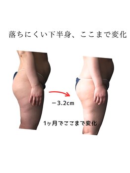ネオボディ(Neo Body)/施術3回目/1ヶ月後途中経過