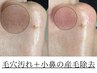 ＼透明ツヤ肌／老化角質のピーリングで感動卵肌♪全顔毛穴洗浄+小鼻のWAX脱毛