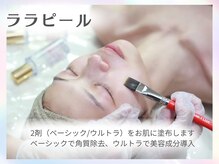 ホワイトアクア 梅田本店(WHITE AQUA)/ララピール/毛穴/梅田