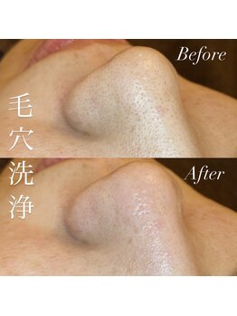 アース コアフュールボーテ 上越店(EARTH coiffure beaute)/毛穴洗浄