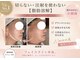 ナナラの写真