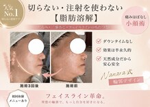 ナナラ