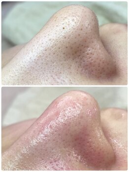 プアラ(puala)/何をしても納得いかなかったのに