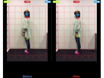 ケアルーム 茅ヶ崎(CAREroom)/施術効果写真☆(before after)