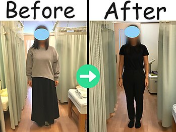 杉本接骨鍼灸院/【ダイエット】34歳 &nbsp;18.2kg