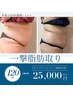 一撃脂肪取りセット　キャビテーション＋脂肪冷却2cup＋皮下＋内臓脂肪とり