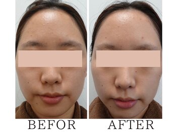 サロンドムーン(salon de MooN)/症例写真