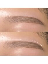 ラフ バイ スリーエヌ(Laugh by NNN)/平行アーチ