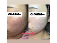 何をやっても綺麗にならない。当店にご相談下さい。