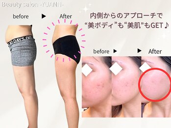 ヨサパーク ユアン(YOSA PARK yuann)