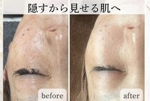 デュモンド(dumonde)