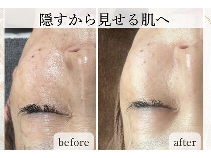 デュモンド(dumonde)の写真