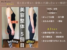 カケル(KAKERU)/施術とセルフケア指導でこの変化