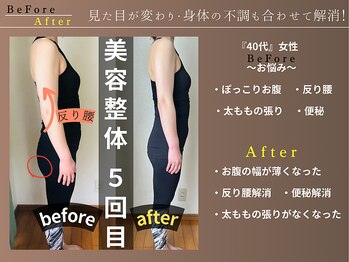 カケル(KAKERU)/施術とセルフケア指導でこの変化