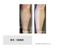 リュール(Lueur)の雰囲気（メンズ足脱毛も人気です♪）