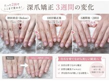 エルフネイル(Elf nail)