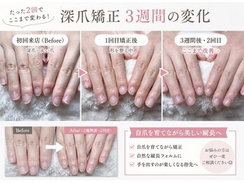 エルフネイル(Elf nail)の写真/噛み爪・深爪OK。自爪風ナチュラルな美しい仕上がり
