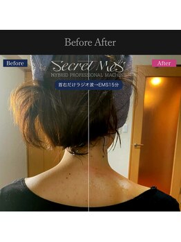 フルオール(FRUOR)の写真/首肩こり・眼精疲労・スマホ疲れを改善しながらリフトアップ◎